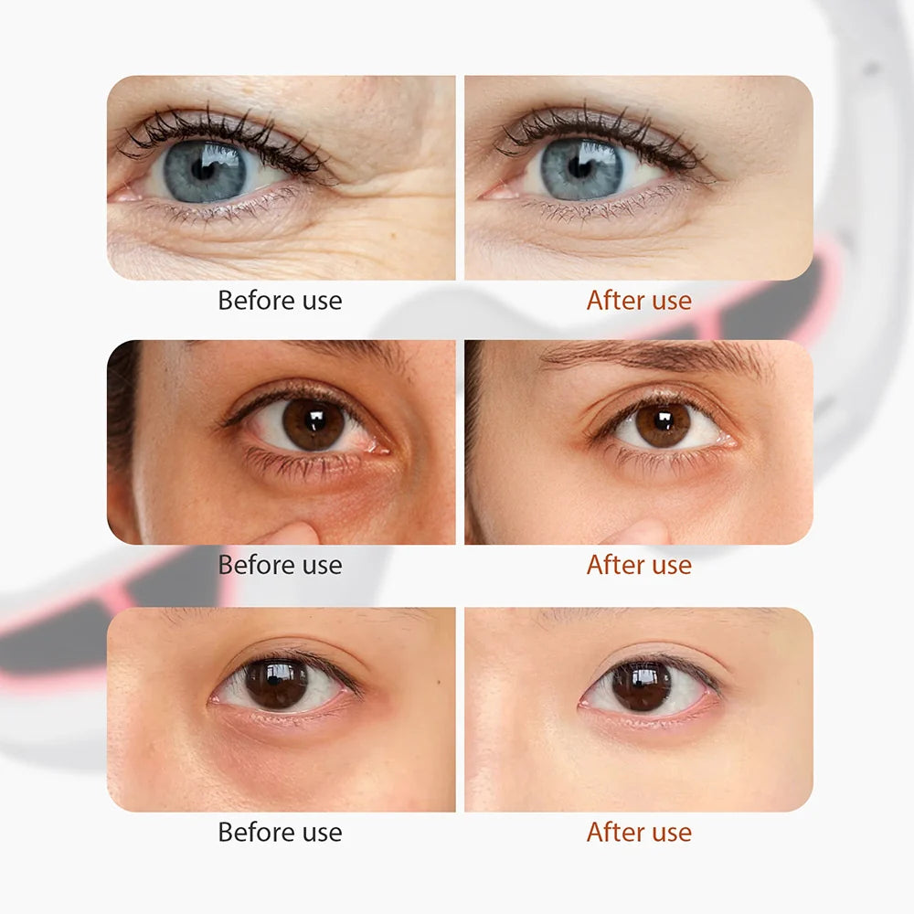 Wake Up With Youthful, Vibrant Eyes